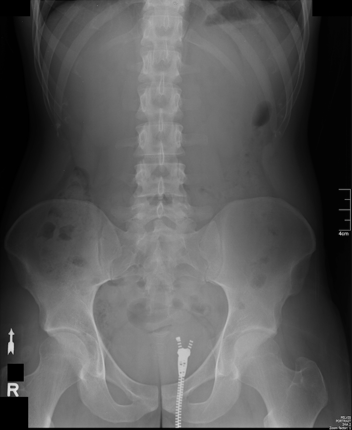 Screen Shot 2017-02-26 at 6.04.45 PM.png